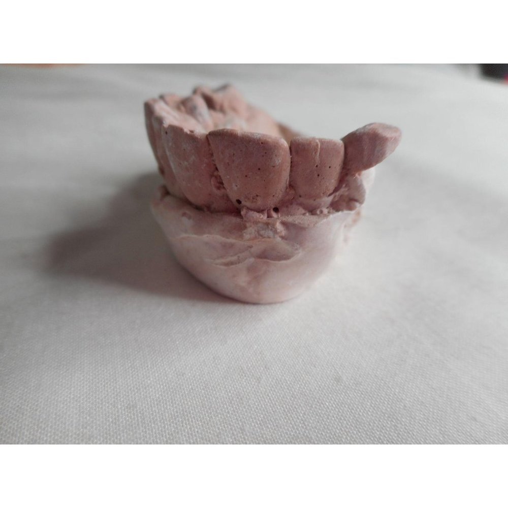Vintage Cast Dental Teeth Mold  Tooth Castings #11 - Picture 2 of 5